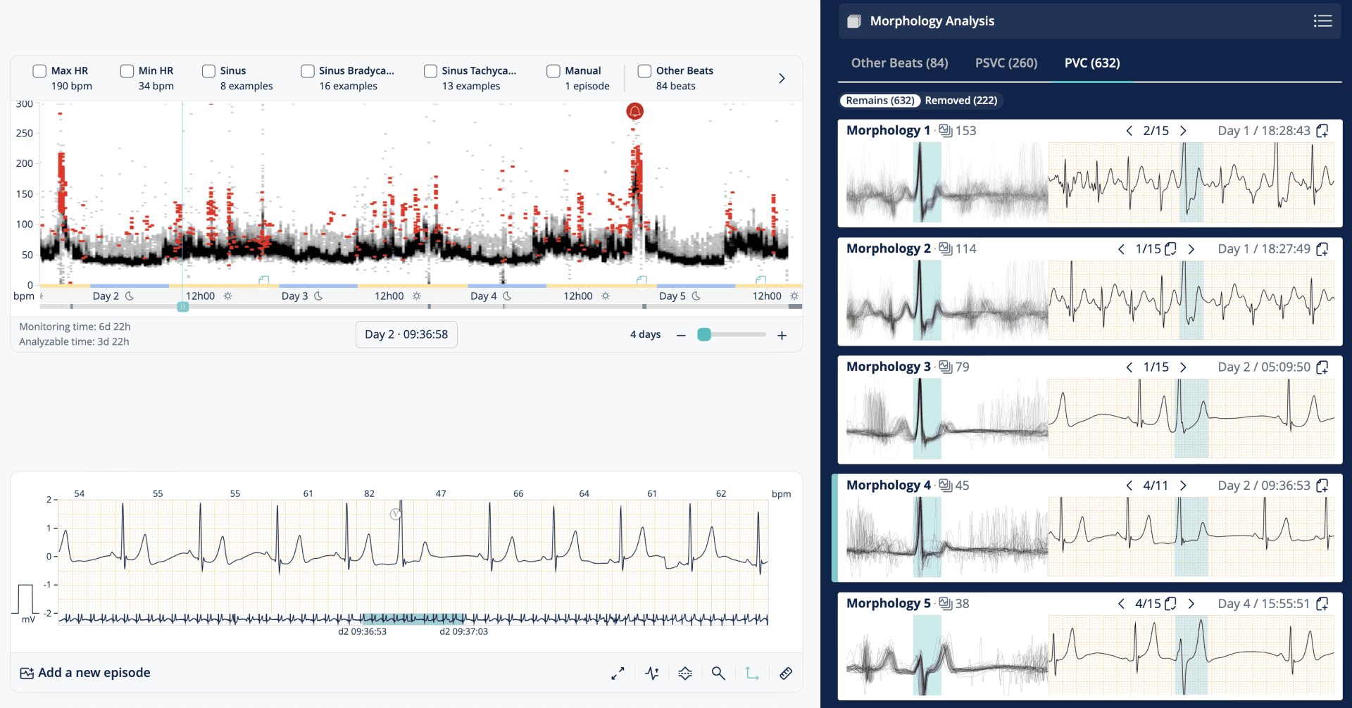 cardiologs holter longterm