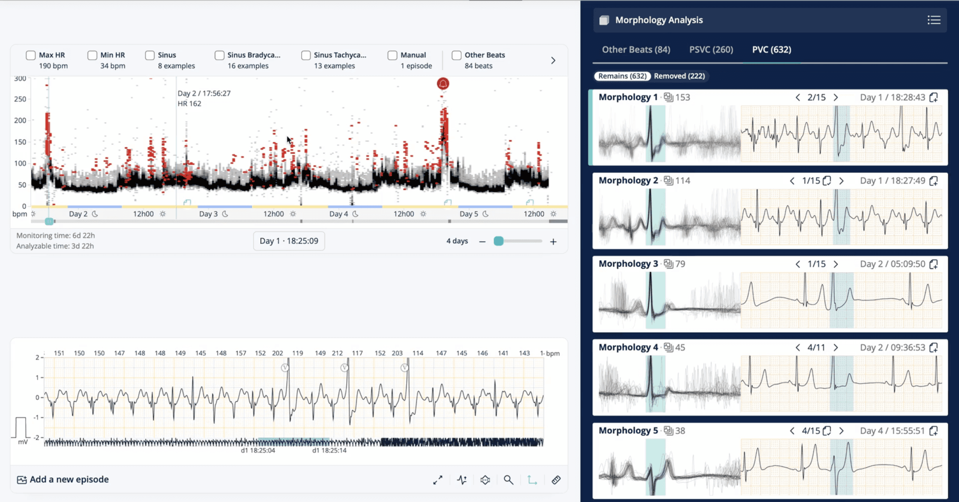 long term holter ecg analysis