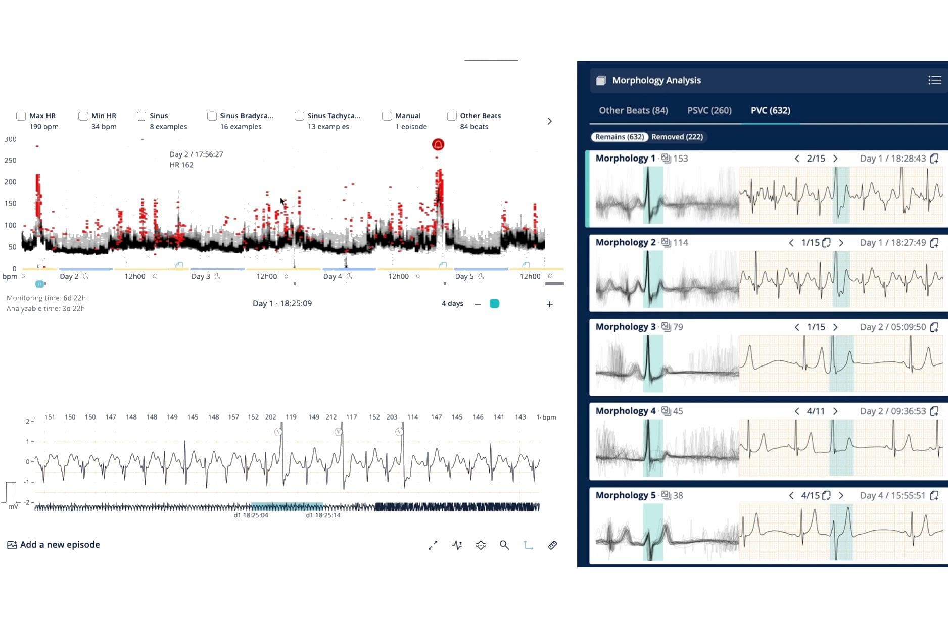 holter analysis