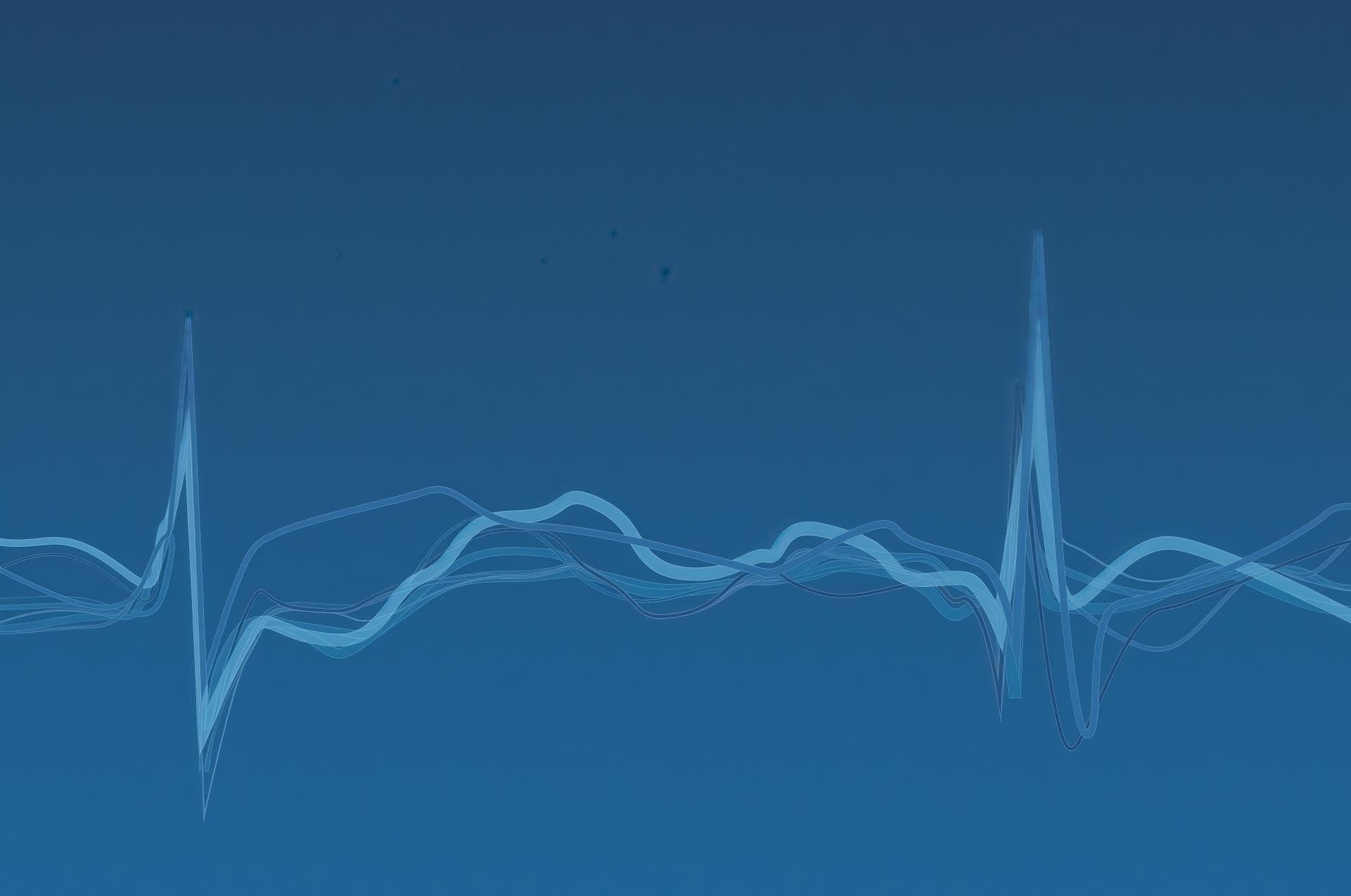 ECG